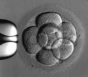 Созданы человеческие эмбрионы с генами трех родителей. Фото с сайта Cybersecurity.ru