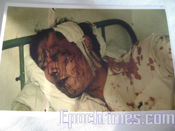 Раненые в результате стычки с полицией крестьяне. Фото: The Epoch Times