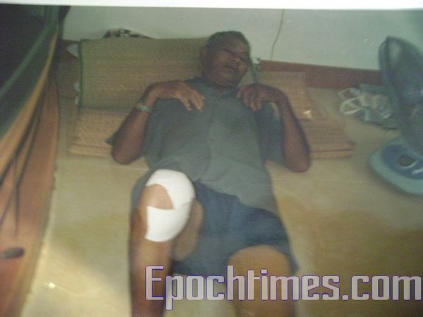 Раненые в результате стычки с полицией крестьяне. Фото: The Epoch Times