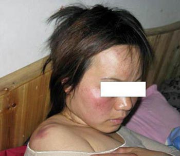 В Китае насильно стерилизуют женщин