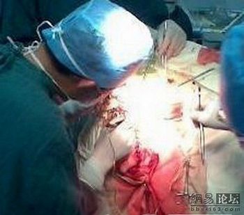 Китайские хирурги по ошибке прооперировали не ту ногу пациента. Фото с epochtimes.com
