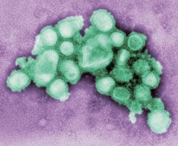 Вирус гриппа H1N1. Фото: AFP