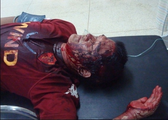 Избитый людьми в полицейской форме Ли Чжишэнь 12 часов был без сознания. Провинция Фуцзянь. Август 2011 год. Фото прислал житель деревни