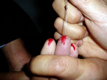 У Чжун Шицюн отобрали одежду, приставленные к ней заключённые стали вгонять ей под ногти швейные иголки.Фото:minghui.org