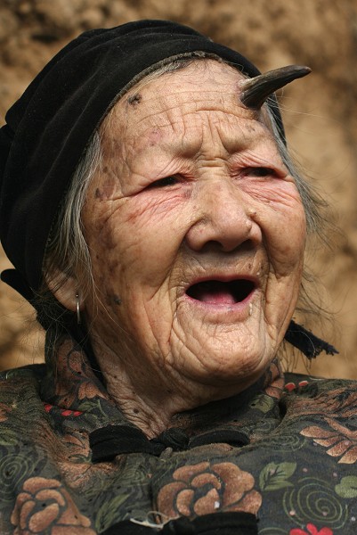 У столетней китаянки начали расти рога.Фото:epochtimes.com