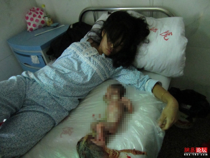Фэн Цзянмэй и её мёртвый ребёнок. Июнь 2012 год. Фото с epochtimes.com