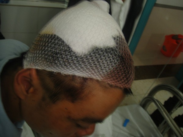 Крестьянин, пострадавший во время протеста. Провинция Гуандун. Март 2012 год. Фото с epochtimes.com