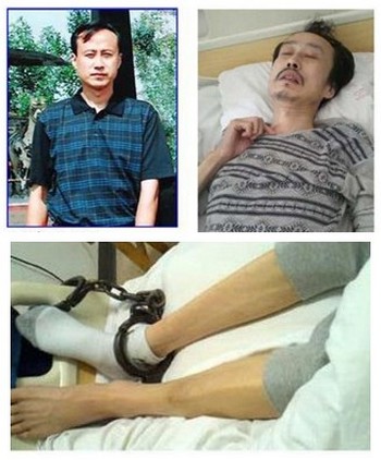 Последователь Фалуньгун Ди Хуэй находится в больнице в критическом состоянии после пыток в полиции. Фото: minghui.org