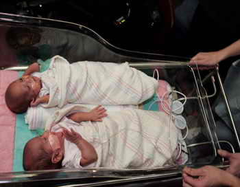 За прошлый год в Москве родились около двух тысяч двойняшек. Фото: Scott Olson/Getty Images
