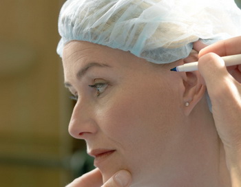 Подтяжка лица – одна из самых популярных пластических операций. Фото: Jonatan Fernstrom/Getty Images