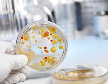 Микрофлора кишечника определяет склонность к заболеваниям. Культуры бактерий, высеянных из организма. Фото: Andreas Reh/ Getty Images