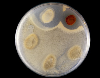 К несчастью микроорганизмы стали резистентны к антибиотикам. Это произошло от их бесконтрольного употребления. Идет постоянная борьба человека и микромира. Фото: Dr. Brad Mogen/Getty Images