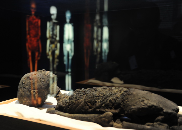 Трёхмерная компьютерная модель мумии Тутанхамона, созданная британскими учёными, помогла выяснить, отчего фараон умер в столь раннем возрасте. Оказалось, что он погиб под колёсами боевой колесницы. Фото: STAN HONDA/AFP/GettyImages