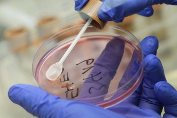 Кишечная инфекция E.coli обнаружена во Франции