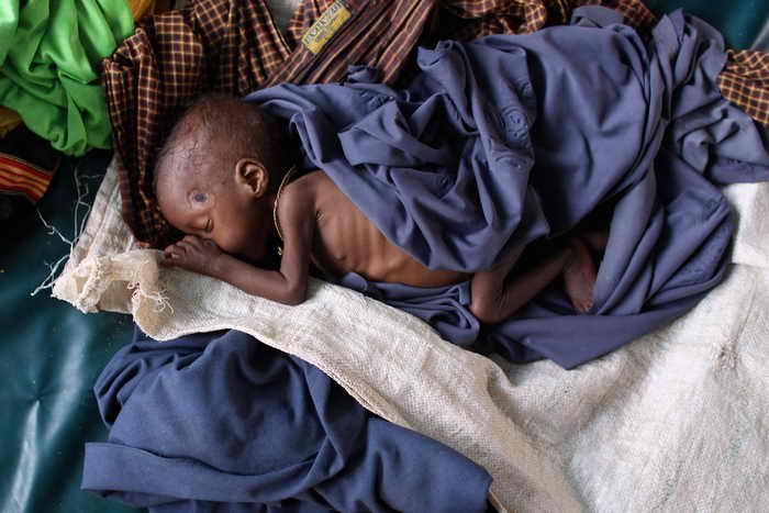 Три миллиона детей умирают ежегодно от плохого питания и недоедания. Фото: Oli Scarff/Getty Images