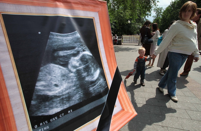 Штраф за незаконные аборты увеличится до 1 млн рублей. Фото: Alexey SAZONOV/AFP/Getty Images