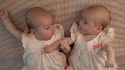 Уникальные близнецы! Они родились с интервалом в три месяца