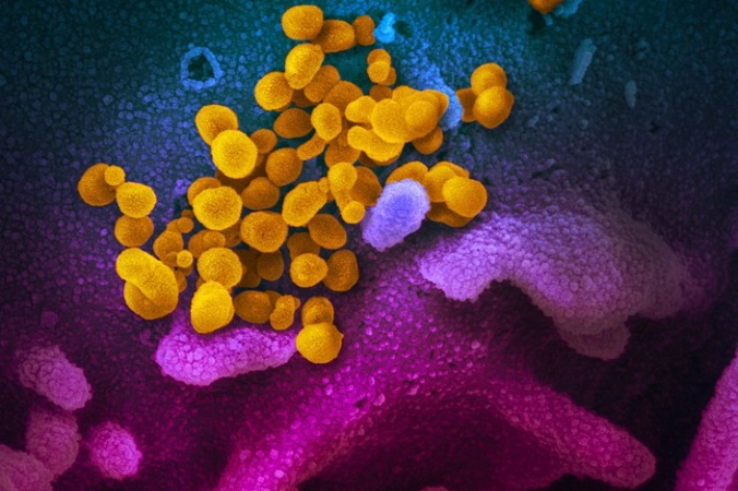 Коронавирус SARS-CoV-2   NIAID Rocky Mountain Laboratories (RML), NIH США/commons.wikimedia.org/Общественное достояние | Epoch Times Россия