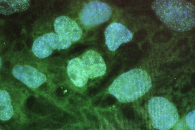 Стволовые клетки под микроскопом. Фото: Spencer Platt/Getty Images | Epoch Times Россия