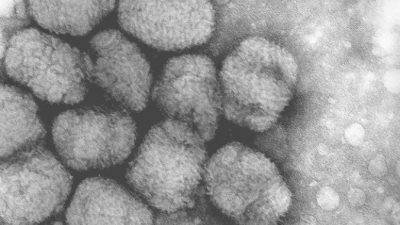 Мириады вирусов живут в микрофлоре нашего кишечника спокон веков
