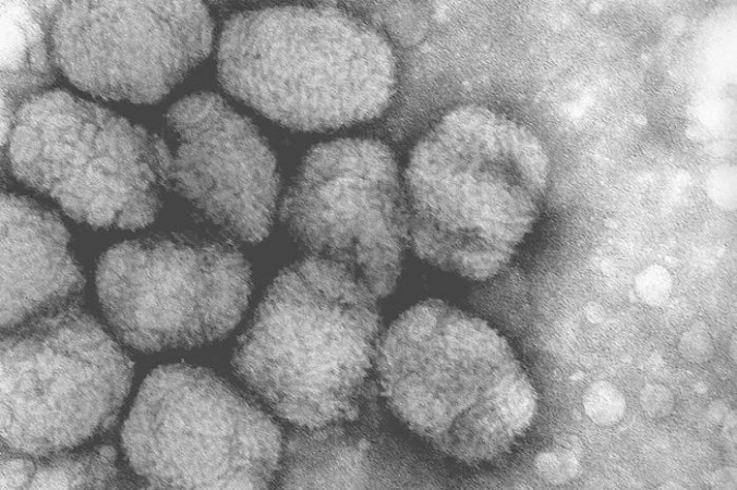 Вирус натуральной оспы представлен двумя видами: Variola major (летальность 20—40%, по некоторым данным — до 90%) и Variola minor (летальность 1-3%). Эти вирусы относятся к семейству Poxviridae, рода Orthopoxvirus. Фото: commons.wikimedia.org/CC0 Public Domain | Epoch Times Россия