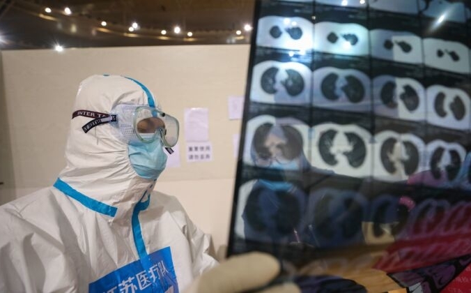 Врач смотрит на компьютерную томографию пациента во временной больнице в Ухане, Китай, 5 марта 2020 года. STR / AFP через Getty Images | Epoch Times Россия