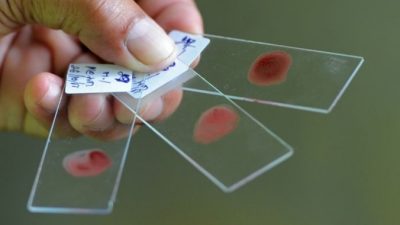 Определяет ли группа крови индивидуальность человека?