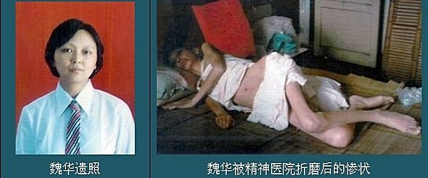 Последовательница Фалуньгун Вэй Хуа. Умерла после освобождения из психиатрической лечебницы города Чунцина. Слева фотография до репрессий, справа — после применения психотропных препаратов. Фото: minghui.org | Epoch Times Россия