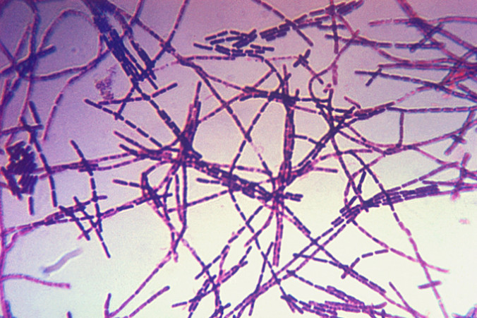 Бактерии, вызывающие сибирскую язву. Фото: Content Providers/wikipedia.org/public domain | Epoch Times Россия
