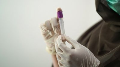 Российская вакцина против ВИЧ прошла II фазу клинических исследований