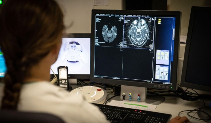 Сканирование мозга 77-летнего пациента с признаками инсульта. BSIP/Education Images/Universal Images Group via Getty Images | Epoch Times Россия