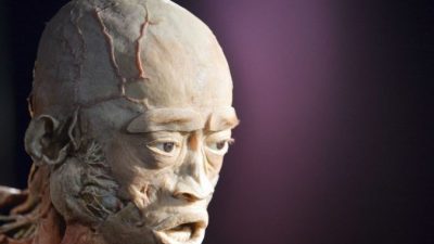 Невропатолог-противник выставки пластинированных тел призывает протестировать образцы тканей