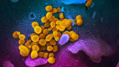 Открытие универсального антитела для всех штаммов коронавируса вызывает сомнения у российских учёных