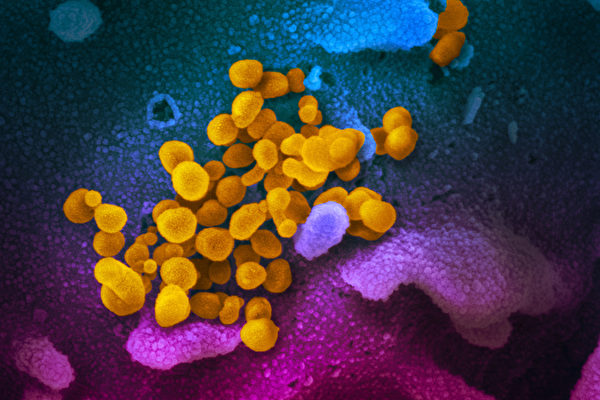 Исследователи из национального института аллергии и инфекционных заболеваний США поделились снимками коронавируса, сделанными с помощью растрового электронного микроскопа NIAID-RML/ flickr.com/CC BY 2.0 | Epoch Times Россия