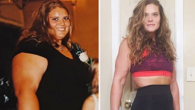 Женщина с ожирением IV степени похудела и теперь помогает в этом другим
