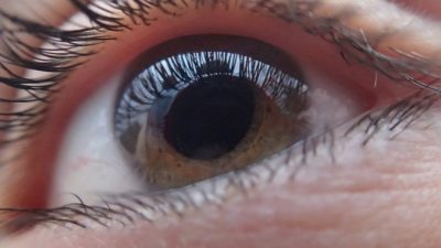 У перенёсших COVID-19 нередко перед глазами появляются пятна