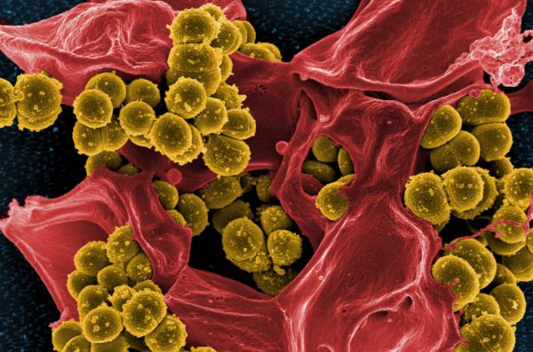 Сканирующая электронная микрофотография метициллин-золотистого стафилококка и мёртвого нейтрофила человека. (Image: NIAID via flickr)