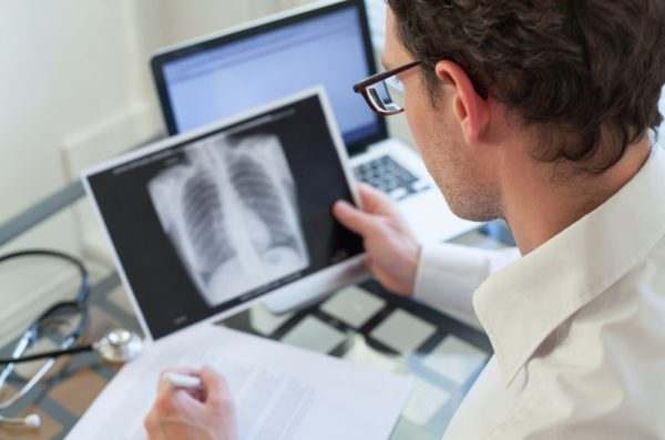 В ситуации, когда кашель длится более двух недель, врач предлагает сделать рентген грудной клетки. (Изображение: Anyaberkut via Dreamstime) | Epoch Times Россия
