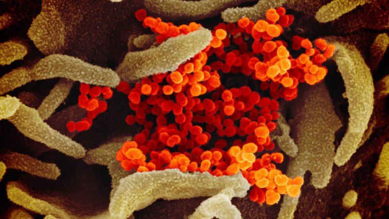 Новый коронавирус (оранжевый), вызывающий заболевание COVID-19, появляется на поверхности клеток (зелёные), культивируемых в лаборатории. Изображение с электронного микроскопа, 13 февраля 2020 г. Фото: NIAID-RML
 | Epoch Times Россия