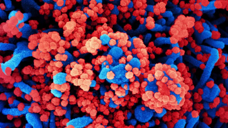 Электронная микрофотография клетки (синий), сильно инфицированной вирусом SARS-CoV-2, частицы (красные), выделенные из образца пациента в Комплексном исследовательском центре NIAID (IRF) в Форт-Детрике, штат Мэриленд, 31 октября 2020 г. Фото: NIAID  | Epoch Times Россия