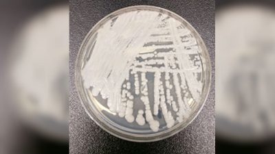 Орегон сообщил о вспышке редкого грибкового заболевания