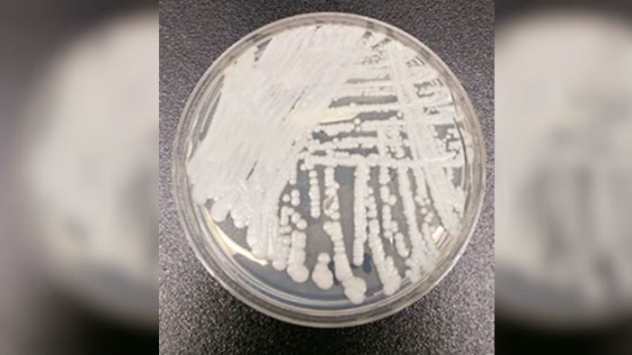 Штамм Candida auris, культивированный в чашке Петри в лаборатории CDC. Фото: Shawn Lockhart/Centers for Disease Control  | Epoch Times Россия