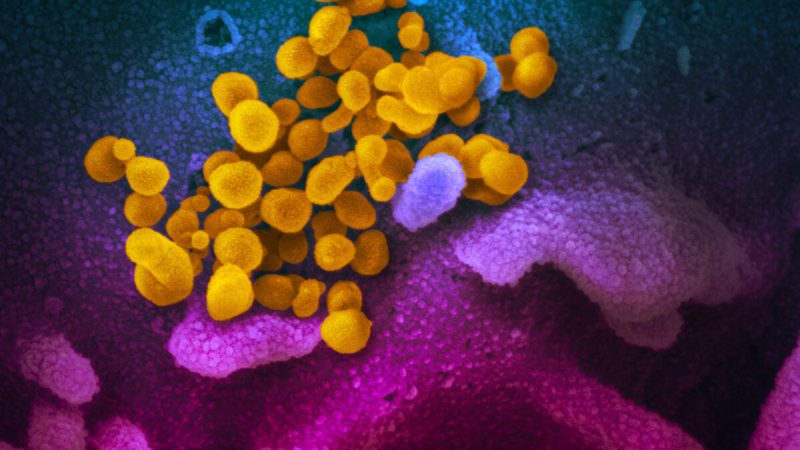 Снимок через электронный микроскоп: жёлтый SARS-CoV-2, появляющийся на поверхности клеток синего/розового цвета, культивируемых в лаборатории. Фото: Courtesy of NIAID-RML
 | Epoch Times Россия