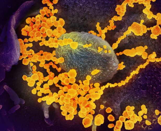 Естественный иммунитет защищает от заражения «Омикроном»