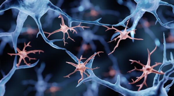 Микроглия — это иммунные клетки в мозге. Во время иммунного ответа микроглии меняют форму, чтобы поглотить патогены, но они могут повредить нейроны и их связи, хранящие память. ART-ur/Shutterstock