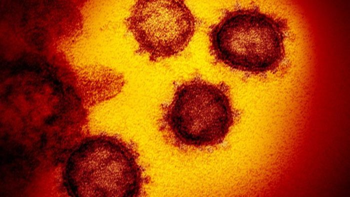 Коронавирус SARS-CoV-2, выделенный от пациента в США.Фото: Niaid-Rml/ZUMA Wire/dpa
 | Epoch Times Россия