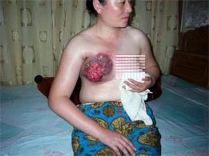 Охранники трудового лагеря «Масаньцзя» в течение нескольких часов били электрическими дубинками по груди последовательницу Фалуньгун Ван Юньцз. Она скончалась в июле 2006 года. (Courtesy of Minghui.org)