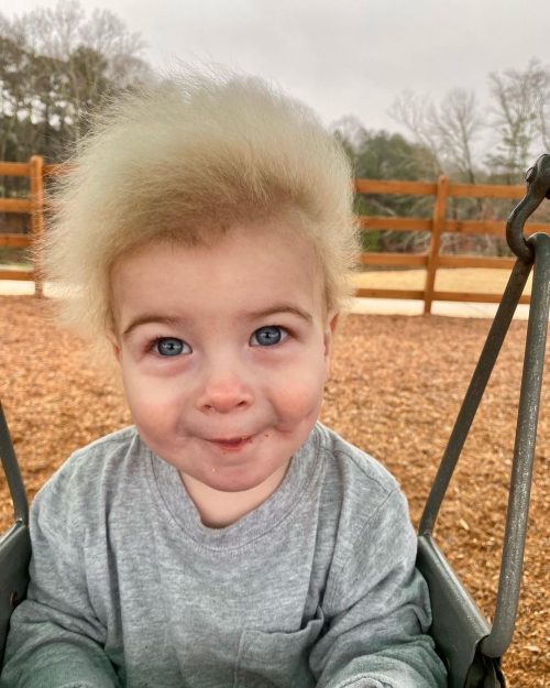 «Его волосы — это благословение»: мальчик с редким синдромом некомбинированных волос вызывает улыбку на лицах людей