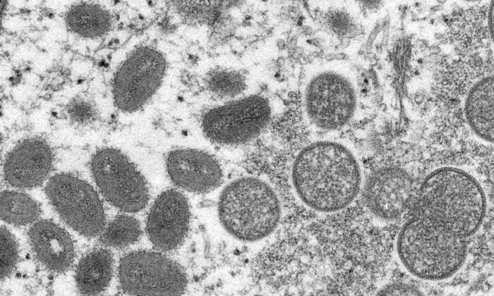 Зрелые вирионы оспы обезьян овальной формы (L) и сферические незрелые вирионы (R), полученные из образца кожи человека, связанного со вспышкой заболевания прерийных собак в 2003 году, на снимке электронного микроскопа 2003 года. (Cynthia S. Goldsmith, Russell Regner/CDC via AP) | Epoch Times Россия
