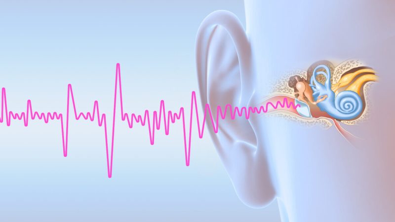  Звон в ушах характеризуется нежелательными звуками, такими как звон или жужжание. Axel_Kock/Shutterstock | Epoch Times Россия